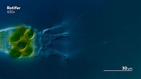  Dictyostelium! En fascinerande reslig genom mikrokosmos, en levande dans av celler som förvandlas till ett släkte