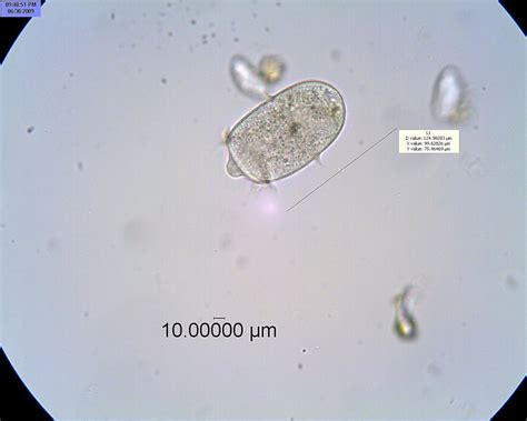  Didinium - En ensidig mikroskopisk predatör som trots sin storlek är en mästare på att fånga byte!