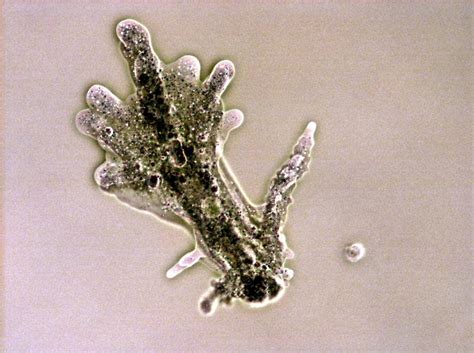  Oreomyxa! En mystisk och fascinerande Amoebozoa som lever i högalpinska bergsskogar