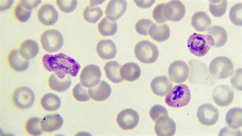  Plasmodium – En Parasit Som Kan Göra Dig Till En Zombie!