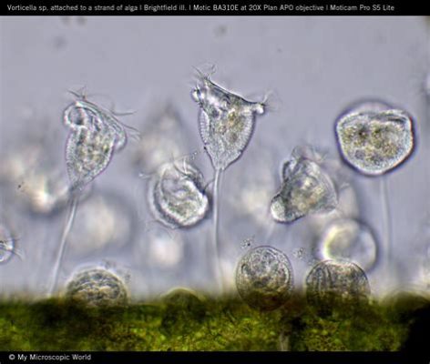  Vorticella! Den lilla virveln som fångar sin mat i en mikroskopisk dans